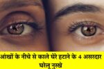 Dark Circles Removal Home Remedies