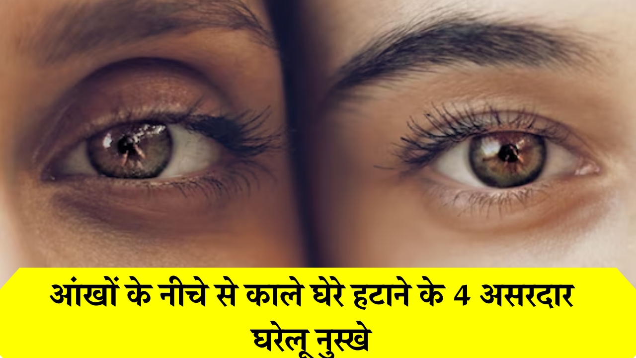 Dark Circles Removal Home Remedies